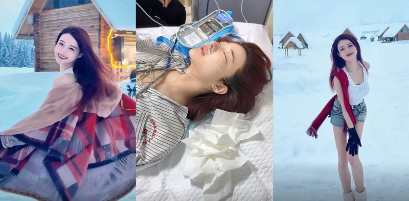 抖音百万粉丝网红 千一 滑雪出意外血溅当场 双腿粉碎性骨折 手术看到电钻榔头 当场崩溃-51吃瓜网