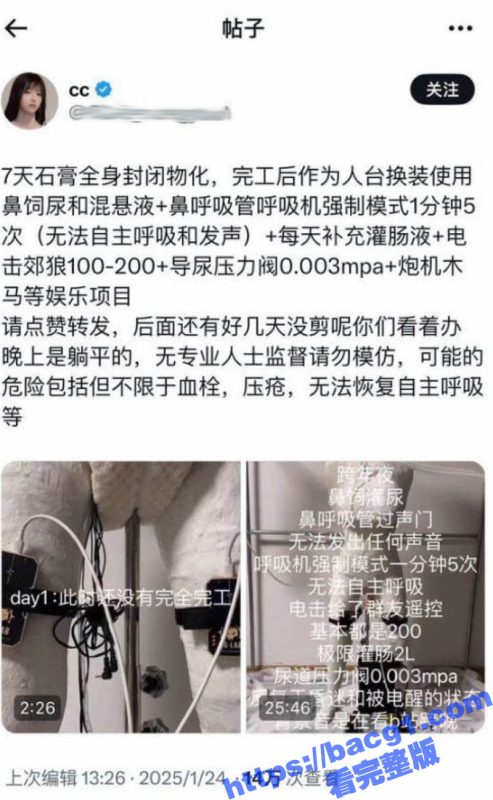 史上最炸裂猎奇佳作！7天石膏全身封闭物化 自动炮机24小时抽插不停 呼吸喂食全用管道！-51吃瓜网